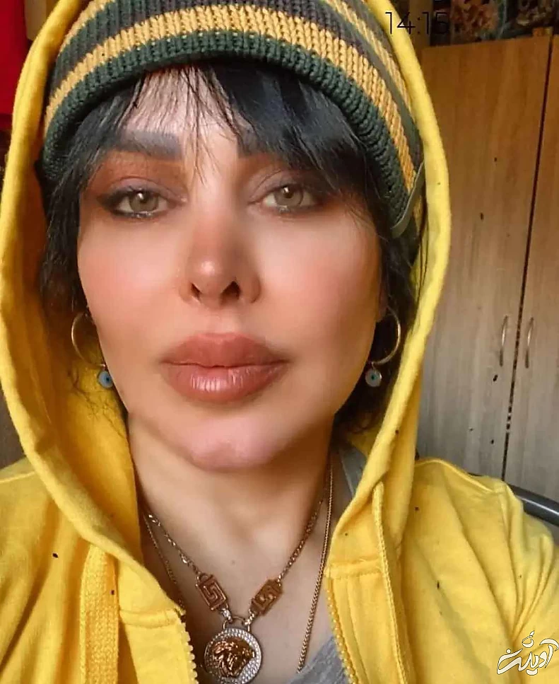 فلور نظری صورتش را کوبید و از نو ساخت ! + ویدیو خانم بازیگر در اروپای سرد